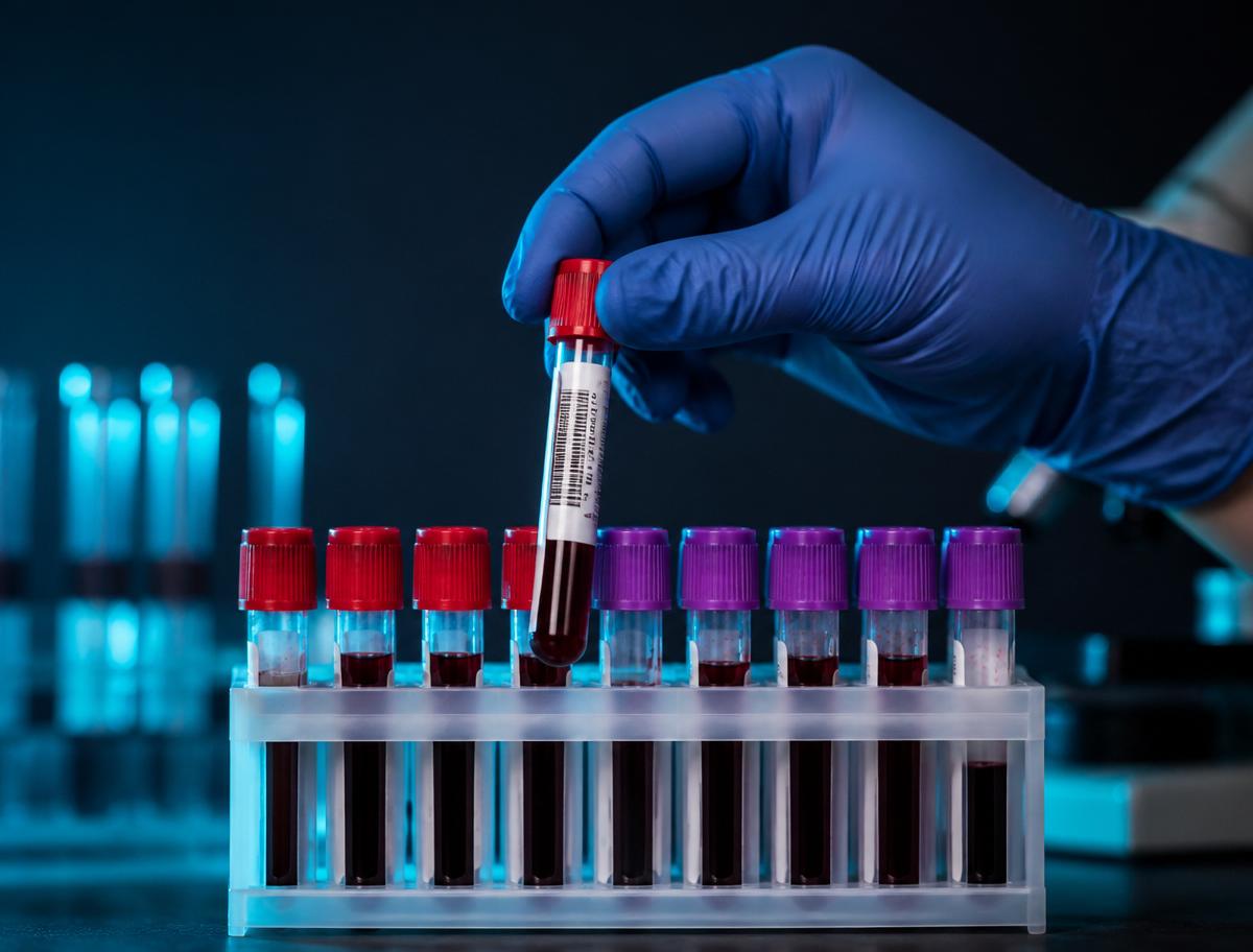 Blood Sample Collection